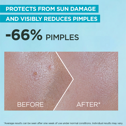 Garnier Super UV Anti-Acne SPF50+ Sunscreen 12H Oil Control 30ml